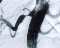 c9-1